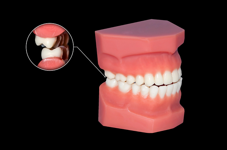 Unknown Factors Contributing to Dental Malocclusions